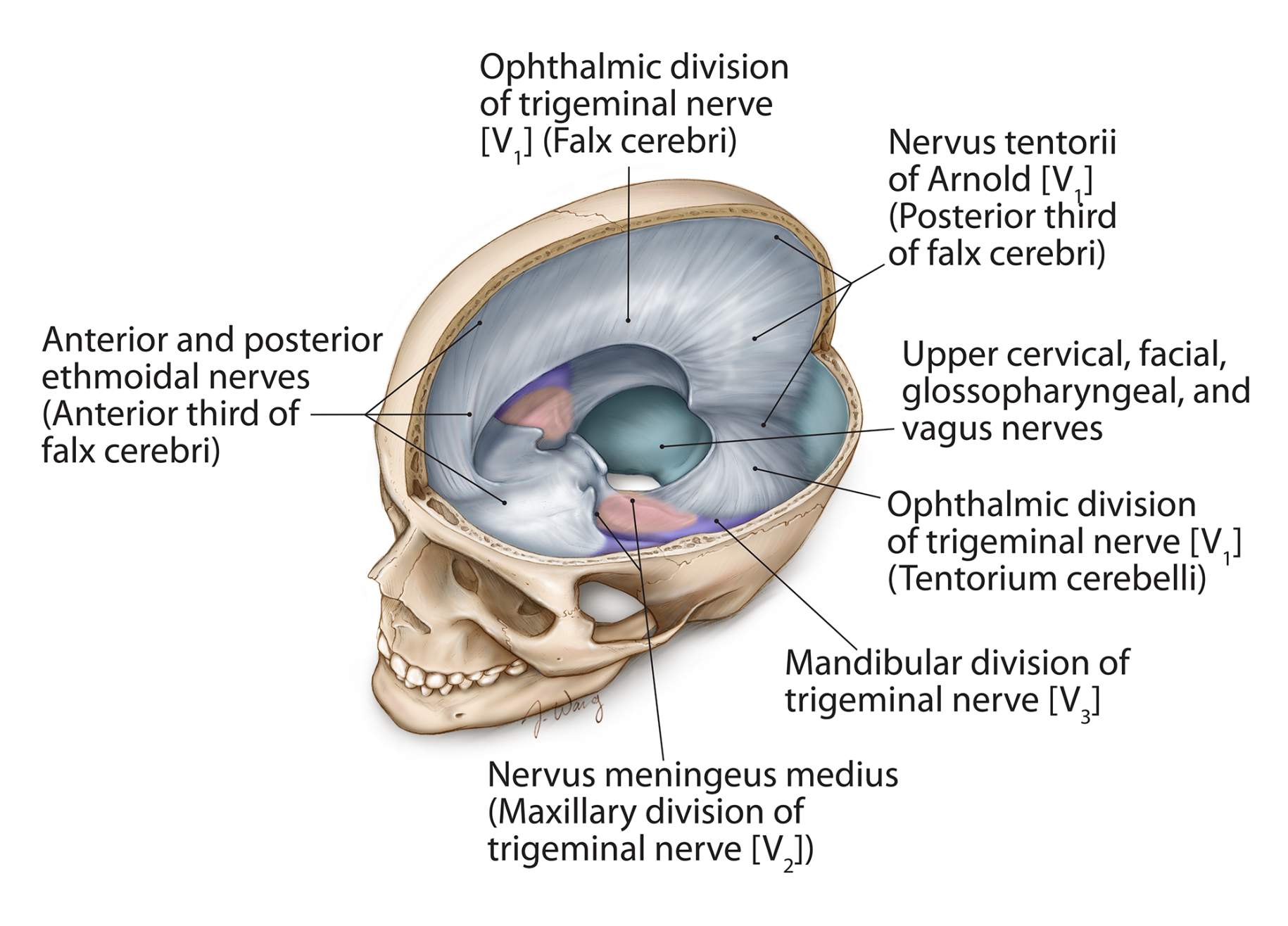Figure 2: The protective covering of the brain (dura) is heavily innervated. Pressure from tumors, such as an acoustic neuroma, can cause pain and headache in a wide variety of distributions.